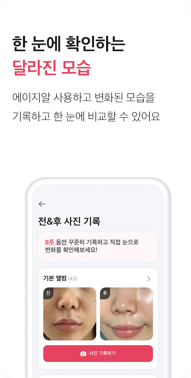 한 눈에 확인하는 달라진 모습, 에이지알 사용하고 변화된 모습을 기록하고 한 눈에 비교할 수 있어